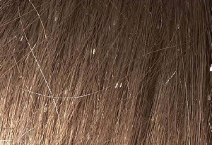 pediculose-piolho-cabeleireiro-salão-de-beleza