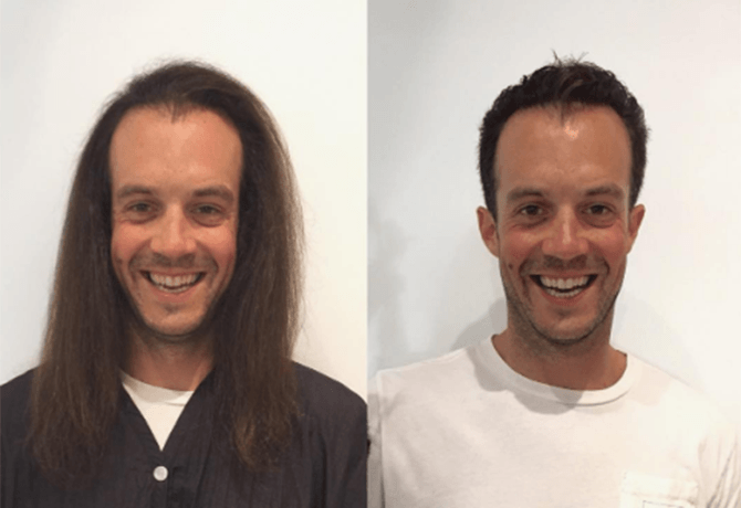 homem antes e depois cabelo